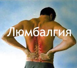 Люмбалгия Лечение Киев