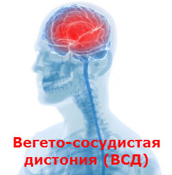 Вегето-сосудистая дистония (ВСД) Лечение Киев